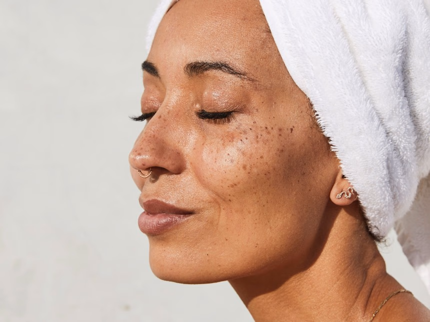 How Dermatologists Really Think About Neck Wrinkles
